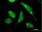 Translocase Of Inner Mitochondrial Membrane 8A antibody, H00001678-B01P, Novus Biologicals, Immunocytochemistry image 