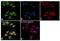 Coronin 1A antibody, PA1-10022, Invitrogen Antibodies, Immunofluorescence image 