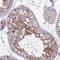 Ubiquitin-conjugating enzyme E2 S antibody, HPA057150, Atlas Antibodies, Immunohistochemistry frozen image 