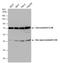 Ceroid-lipofuscinosis neuronal protein 5 antibody, GTX130920, GeneTex, Western Blot image 