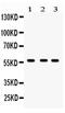 Cytochrome P450 Family 27 Subfamily B Member 1 antibody, PA5-79128, Invitrogen Antibodies, Western Blot image 