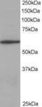 Coronin 1A antibody, PA5-18186, Invitrogen Antibodies, Western Blot image 