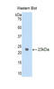Gamma-Glutamyltransferase 1 antibody, LS-C294018, Lifespan Biosciences, Western Blot image 