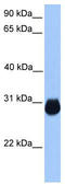 Insulin Like Growth Factor Binding Protein 7 antibody, TA346551, Origene, Western Blot image 