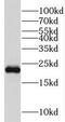 KRAS Proto-Oncogene, GTPase antibody, FNab10239, FineTest, Western Blot image 