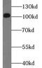 DExD/H-Box Helicase 58 antibody, FNab02318, FineTest, Western Blot image 