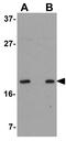OCIA Domain Containing 2 antibody, GTX85232, GeneTex, Western Blot image 