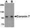 Coronin 7 antibody, PA5-72695, Invitrogen Antibodies, Western Blot image 