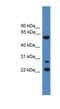 Meiosis Specific Nuclear Structural 1 antibody, NBP1-69201, Novus Biologicals, Western Blot image 