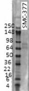 Potassium Voltage-Gated Channel Subfamily D Member 3 antibody, TA326560, Origene, Western Blot image 