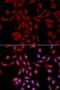 Ubiquitin Conjugating Enzyme E2 I antibody, A13558, ABclonal Technology, Western Blot image 