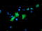 Carnosine Dipeptidase 2 antibody, TA503631, Origene, Immunofluorescence image 