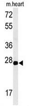 CLDN4 antibody, AP50949PU-N, Origene, Western Blot image 
