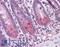 Baculoviral IAP Repeat Containing 6 antibody, LS-B4702, Lifespan Biosciences, Immunohistochemistry paraffin image 