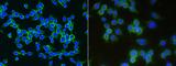 Low Density Lipoprotein Receptor antibody, 50305-R032, Sino Biological, Immunofluorescence image 