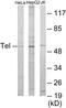 ETS Variant 6 antibody, EKC1718, Boster Biological Technology, Western Blot image 
