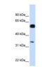 BRISC And BRCA1 A Complex Member 1 antibody, NBP1-56773, Novus Biologicals, Western Blot image 