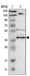 SUFU Negative Regulator Of Hedgehog Signaling antibody, NBP1-87384, Novus Biologicals, Western Blot image 