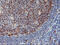 MEP antibody, M03028-1, Boster Biological Technology, Immunohistochemistry paraffin image 