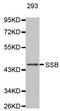 Small RNA Binding Exonuclease Protection Factor La antibody, orb136357, Biorbyt, Western Blot image 