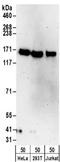Tubulin Tyrosine Ligase Like 5 antibody, NBP2-32091, Novus Biologicals, Western Blot image 