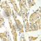 Histamine N-Methyltransferase antibody, A2520, ABclonal Technology, Immunohistochemistry paraffin image 