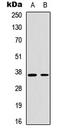 Cyclin-H antibody, LS-C358931, Lifespan Biosciences, Western Blot image 