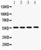 SMAD Family Member 3 antibody, LS-C357590, Lifespan Biosciences, Western Blot image 