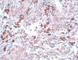Breast Carcinoma Amplified Sequence 1 antibody, NBP1-77123, Novus Biologicals, Immunohistochemistry frozen image 