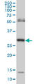 DNA-3-methyladenine glycosylase antibody, LS-C133326, Lifespan Biosciences, Western Blot image 