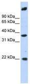 Single-stranded DNA-binding protein 3 antibody, TA333761, Origene, Western Blot image 