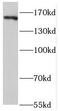 Rho Associated Coiled-Coil Containing Protein Kinase 2 antibody, FNab07378, FineTest, Western Blot image 
