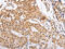 RING finger and CHY zinc finger domain-containing protein 1 antibody, CSB-PA213853, Cusabio, Immunohistochemistry frozen image 