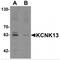 Potassium channel subfamily K member 13 antibody, MBS150682, MyBioSource, Western Blot image 