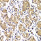 Diacylglycerol Kinase Epsilon antibody, A06615-1, Boster Biological Technology, Immunohistochemistry paraffin image 