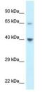 Atypical Chemokine Receptor 4 antibody, NBP1-79925, Novus Biologicals, Western Blot image 
