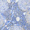 Myogenin antibody, LS-C334865, Lifespan Biosciences, Immunohistochemistry frozen image 