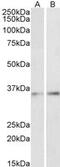 CCAAT Enhancer Binding Protein Beta antibody, MBS423383, MyBioSource, Western Blot image 