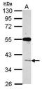 V-Set And Immunoglobulin Domain Containing 1 antibody, PA5-31993, Invitrogen Antibodies, Western Blot image 