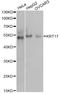 Keratin 17 antibody, LS-C746712, Lifespan Biosciences, Western Blot image 