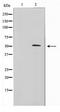 Zinc Finger Protein 436 antibody, TA347591, Origene, Western Blot image 