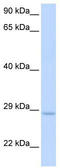 DNA repair protein XRCC2 antibody, TA344287, Origene, Western Blot image 