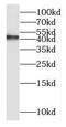NADH-ubiquinone oxidoreductase chain 2 antibody, FNab05598, FineTest, Western Blot image 