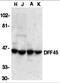 DNA Fragmentation Factor Subunit Alpha antibody, 1141, ProSci Inc, Western Blot image 