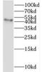 Indian Hedgehog Signaling Molecule antibody, FNab04194, FineTest, Western Blot image 