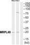 Mitochondrial Ribosomal Protein L49 antibody, abx014598, Abbexa, Western Blot image 