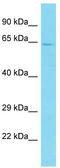Centromere Protein T antibody, TA335454, Origene, Western Blot image 