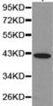 Killer cell immunoglobulin-like receptor 2DL1 antibody, TA322391, Origene, Western Blot image 