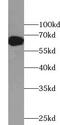 Zinc Finger Protein 326 antibody, FNab09686, FineTest, Western Blot image 