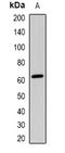Very long-chain specific acyl-CoA dehydrogenase, mitochondrial antibody, orb377891, Biorbyt, Western Blot image 